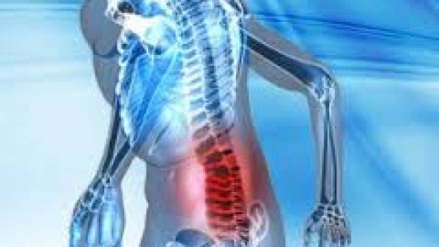 Ozonoterapia: Tratamiento alto en antioxidantes